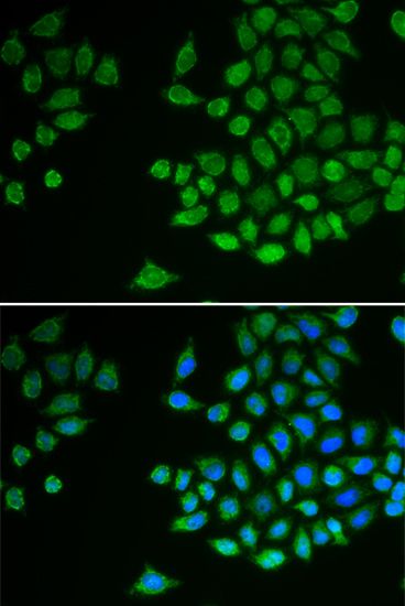 Immunofluorescence - PTPN2 antibody (144-01808)