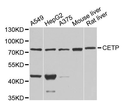 Western blot - CETP antibody (144-01355)