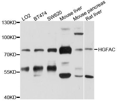 Western blot - HGFAC Polyclonal Antibody (144-600504)