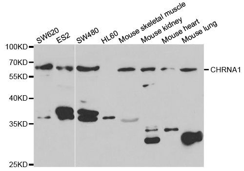 Western blot - CHRNA1 antibody (144-05306)