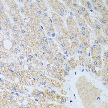 Immunohistochemistry - DLK1 antibody (144-06578)