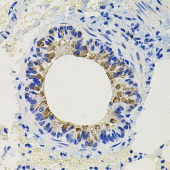 Immunohistochemistry - CALB2 Polyclonal Antibody (144-09807)