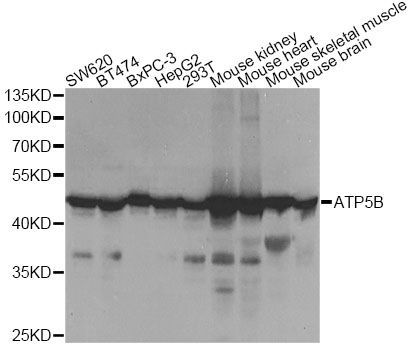 Western blot - ATP5B Polyclonal Antibody (144-05769)
