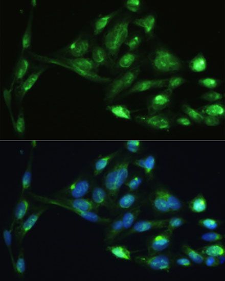 Immunohistochemistry - VIM Polyclonal Antibody (144-011952)