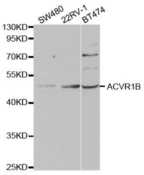 Western blot - ACVR1B Polyclonal Antibody (144-05453)