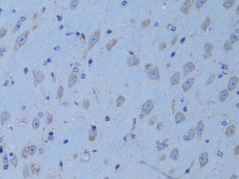 Immunohistochemistry - HADH Polyclonal Antibody (144-01076)