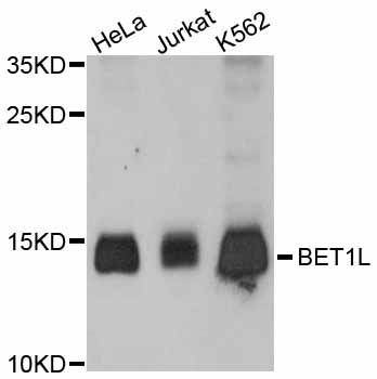 Western blot - BET1L antibody (144-011951)