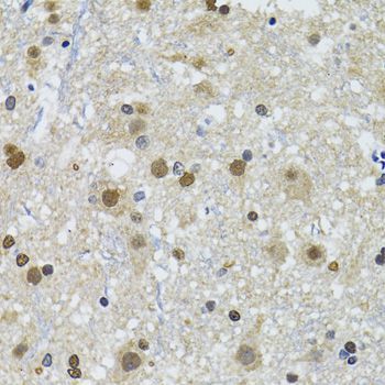 Immunohistochemistry - TP53BP1 antibody (144-05757)