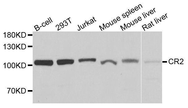 Western blot - CR2 antibody (144-08407)