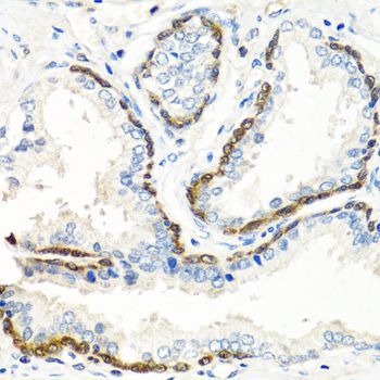 Immunohistochemistry - BMP5 Polyclonal Antibody (144-08401)