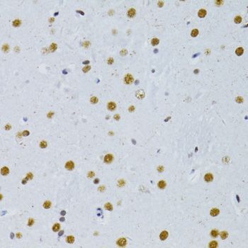 Immunohistochemistry - SNRNP70 antibody (144-06065)