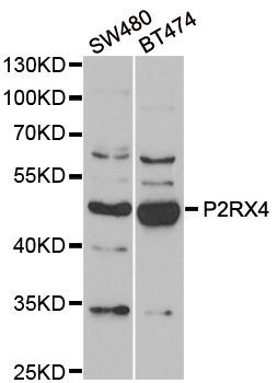 Western blot - P2RX4 Polyclonal Antibody (144-06682)