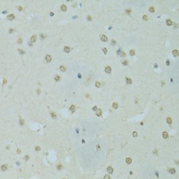 Immunohistochemistry - SAFB antibody (144-07927)