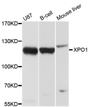 Western blot - XPO1 Polyclonal Antibody (144-00299)