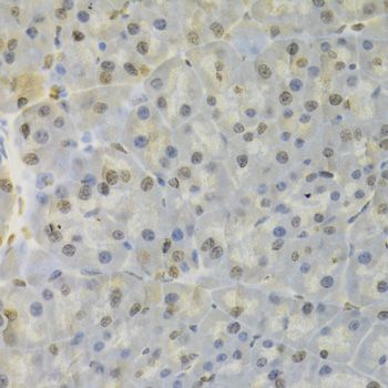 Immunohistochemistry - HNRNPD Polyclonal Antibody (144-01828)