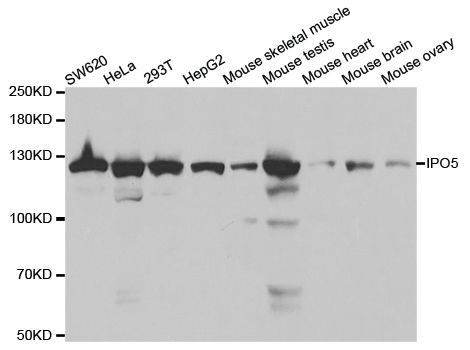 Western blot - IPO5 Polyclonal Antibody (144-01984)
