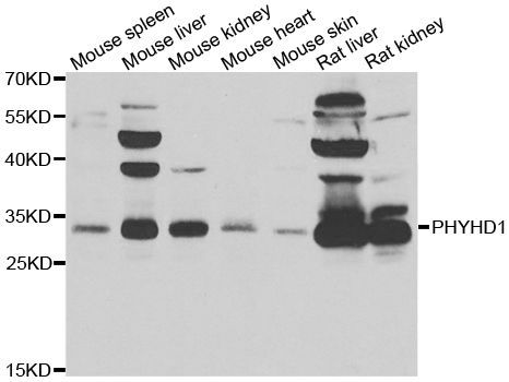 Western blot - PHYHD1 Polyclonal Antibody (144-07208)