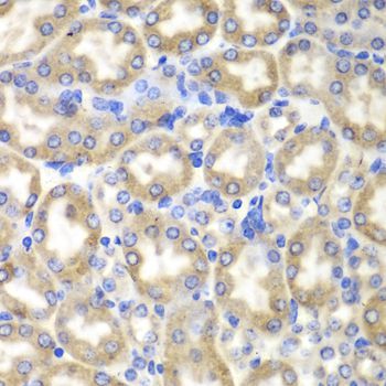 Immunohistochemistry - HADH Polyclonal Antibody (144-01076)