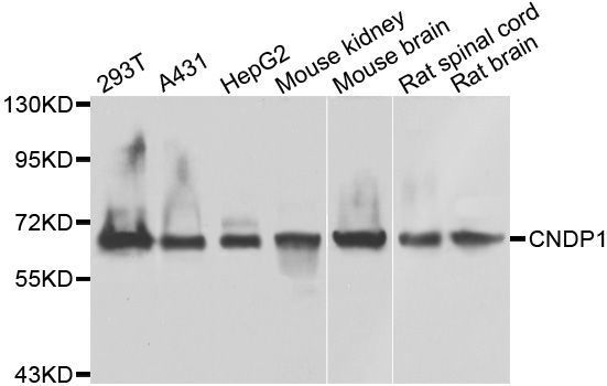 Western blot - CNDP1 antibody (144-07485)