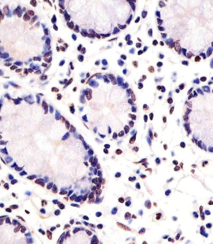 IHC-P