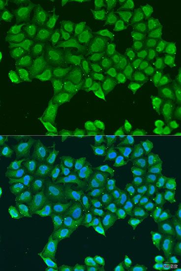 Immunofluorescence - ATP5O Polyclonal Antibody (144-08103)