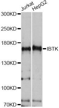 Western blot - IBTK antibody (144-014866)