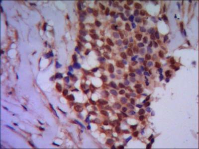 IHC