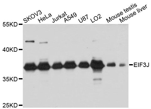 Western blot - EIF3J Polyclonal Antibody (144-08637)