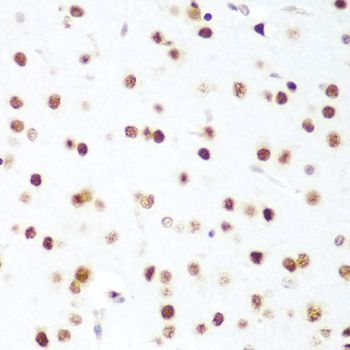 Immunohistochemistry - CDK1 antibody (144-012414)