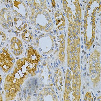 Immunohistochemistry - TNFRSF11B Polyclonal Antibody (144-02100)
