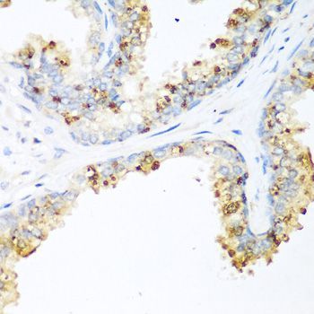 Immunohistochemistry - LRP5 Polyclonal Antibody (144-00130)