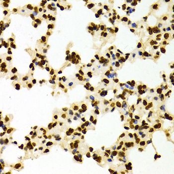 Immunohistochemistry - DiMethyl-Histone H3-K27 pAb (144-02362)