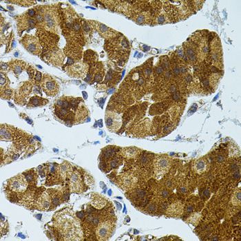 Immunohistochemistry - CETP antibody (144-01355)