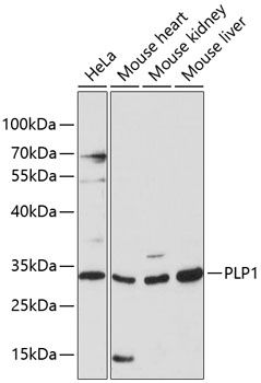 Western blot