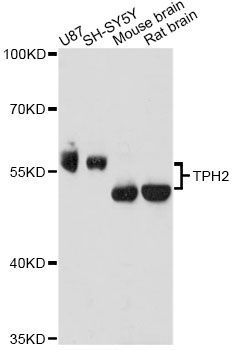 Western blot - TPH2 antibody (144-60692)