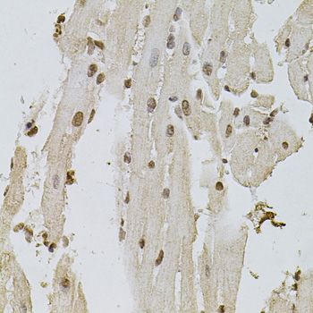 Immunohistochemistry - [KO Validated] EGFR Polyclonal Antibody (144-11351)