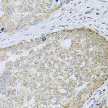 Immunohistochemistry - ANAPC10 antibody (144-08330)