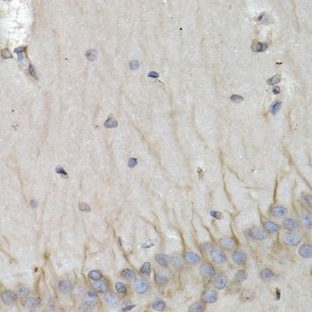 Immunohistochemistry - PSMB10 antibody (144-05452)