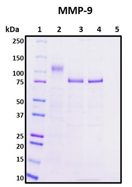 SDS-PAGE image