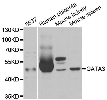 Western blot - GATA3 antibody (144-01638)
