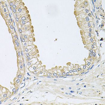 Immunohistochemistry - ANKH antibody (144-09881)