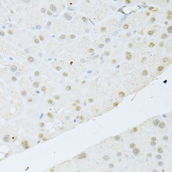Immunohistochemistry - AKT1 Polyclonal Antibody (144-011016)