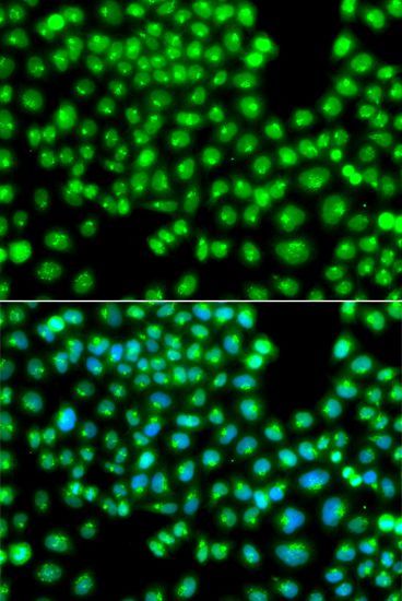 Immunofluorescence - GOPC Polyclonal Antibody (144-07513)