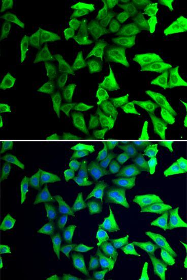 Immunofluorescence - VSNL1 antibody (144-02797)