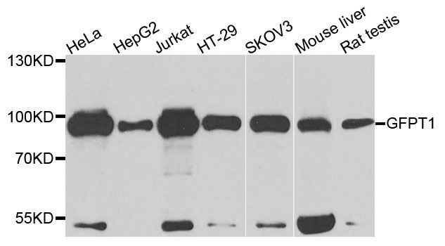 Western blot - GFPT1 antibody (144-03882)