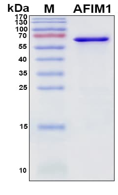 SDS-PAGE Image