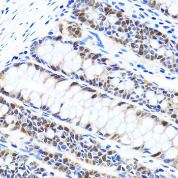 Immunohistochemistry - UHRF1 antibody (144-02343)