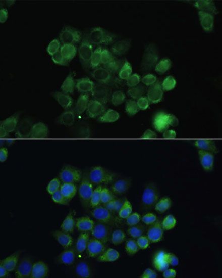Immunofluorescence - TGFB3 Polyclonal Antibody (144-08460)