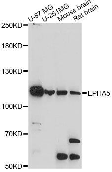 Western blot - EPHA5 antibody (144-60615)