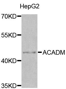 Western blot - ACADM Polyclonal Antibody (144-01873)